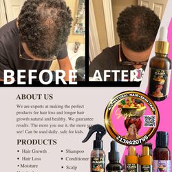 Hair Loss Solution