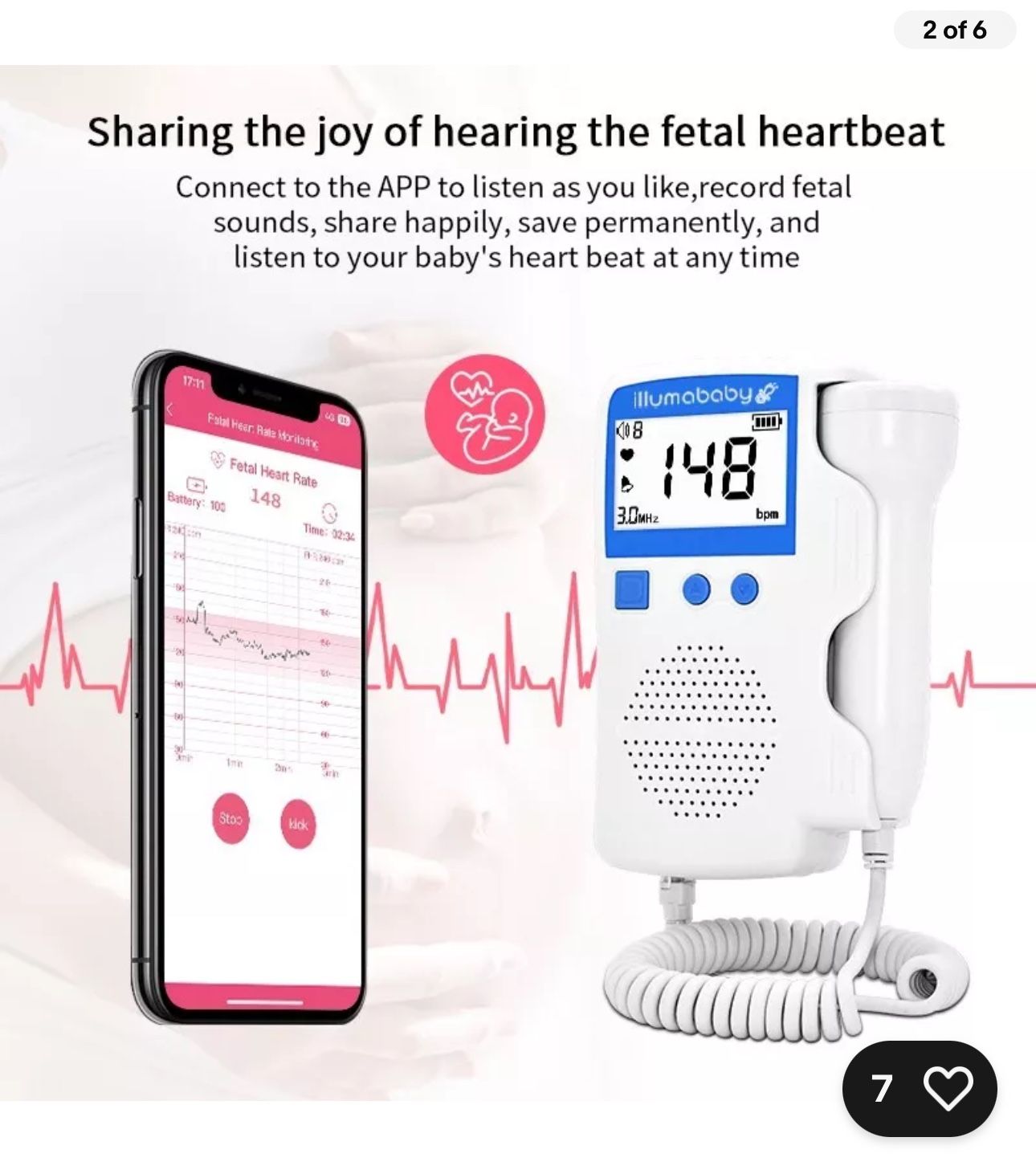 illumababy Rechargeable Baby Doppler Heart Monitor w/ Mobile App