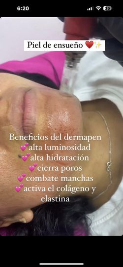 Plasma Rico En plaquetas Prp