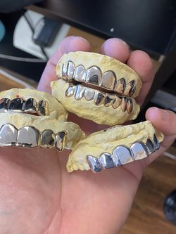 Gold Grillz