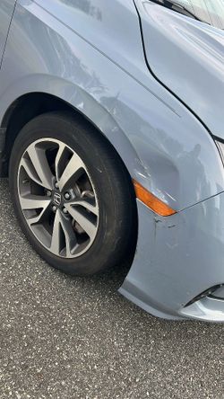Dent Paint