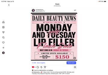 Lip filler