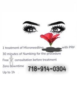 Micro needling PRP