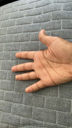 Fake hand