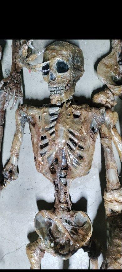 Skeleton Corpses Halloween Props