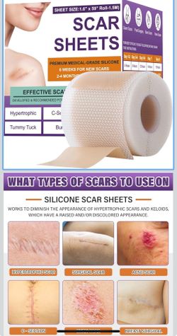 Silicone Scar Sheets,Silicone Scar Tape,Scar Tape For Surgical Scars,Silicone Scar Removal Strips For Surgical,C-Section,Tummy Tuck,Keloid Scars(1.6"X