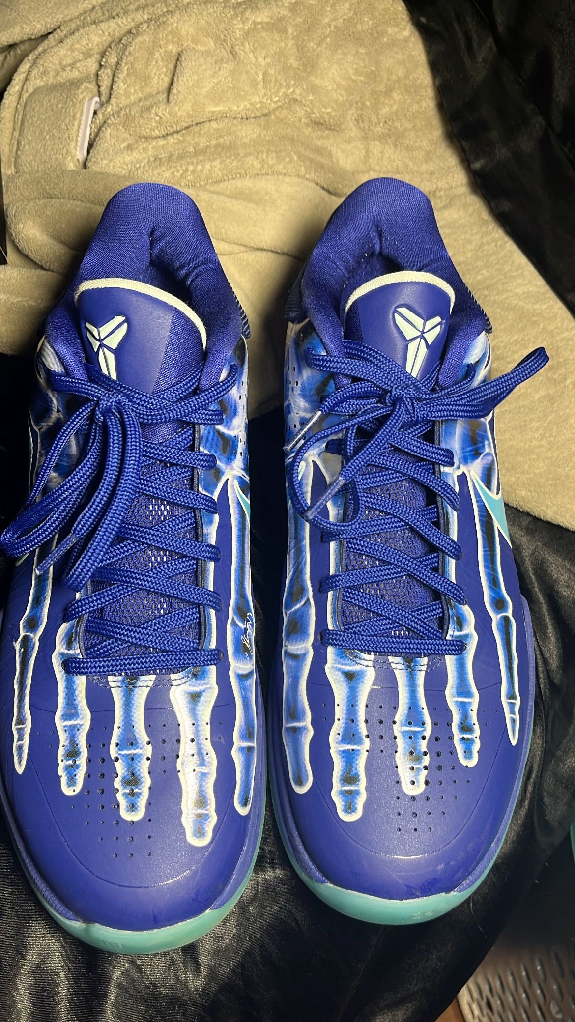 Kobe 5 X-rays