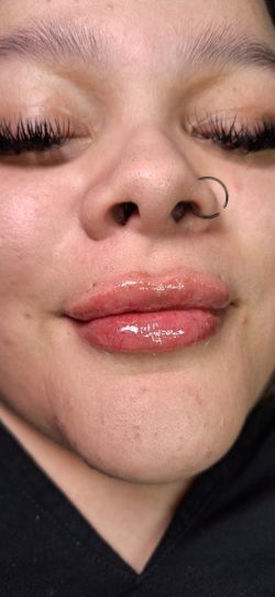 lips