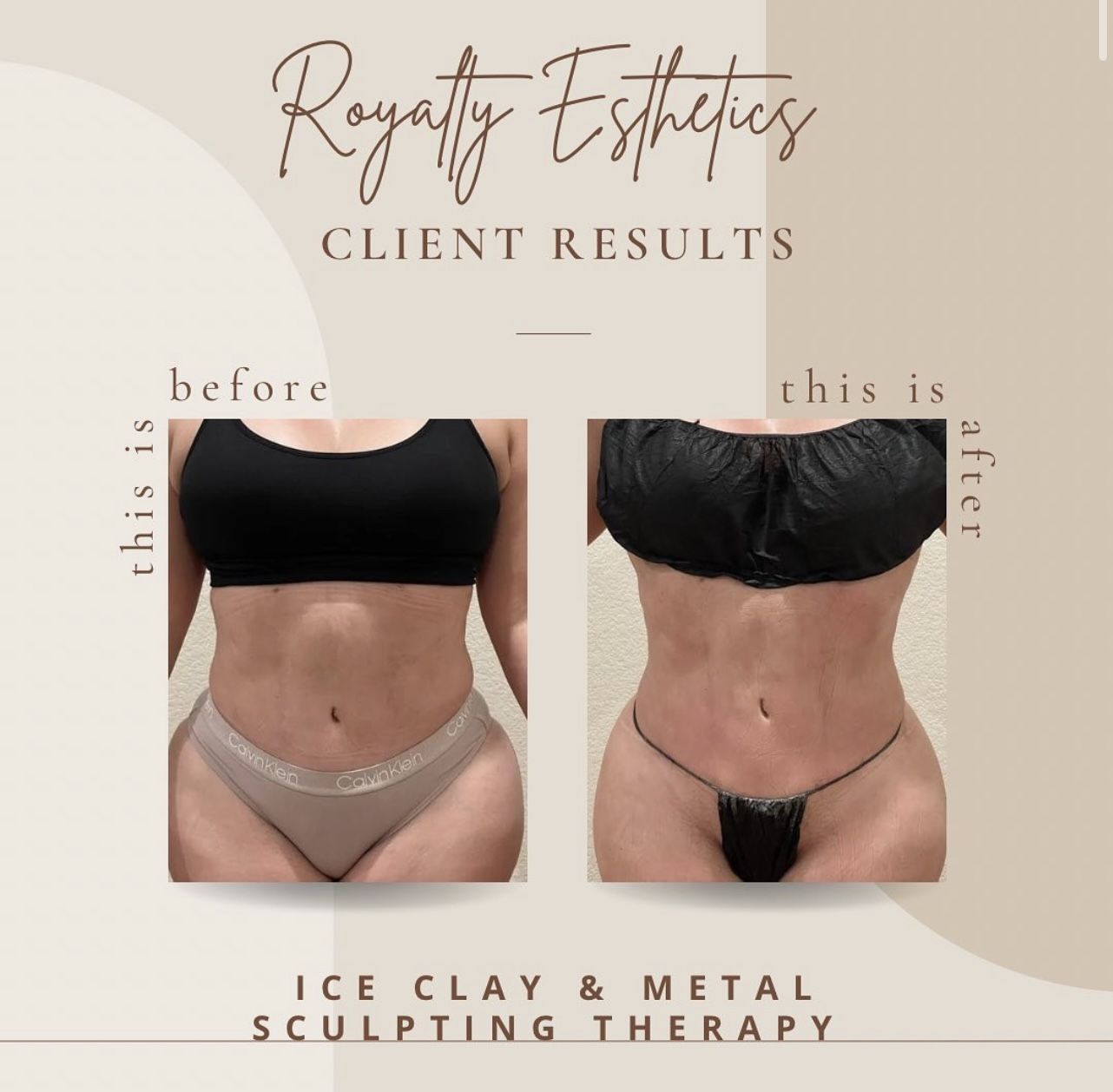 Ice Clay Body Sculpting