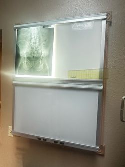 an X-ray view box, also known as an X-ray film illuminator or radiology view box