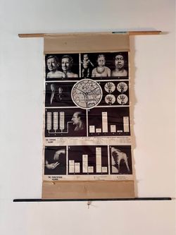 Vintage Parathyroid Medical Poster