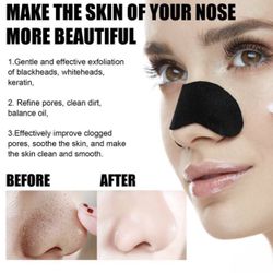 10pcs Blackhead & Whitehead Remover Cleansing Nose Strips