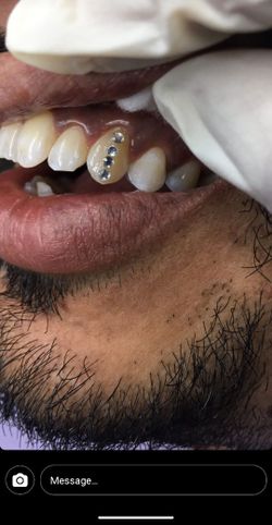 One Gem Free For The Price Of One For First time Clients