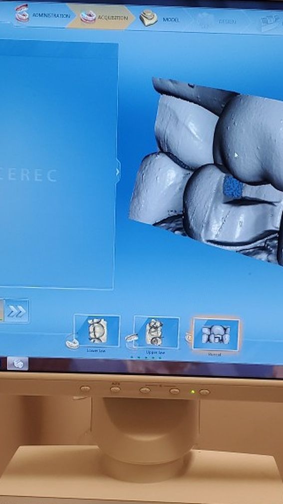 Cerec 3 And Mill Bundle