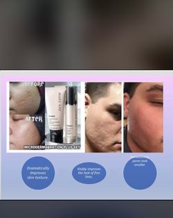 Mary Kay Microdermabrasion Set