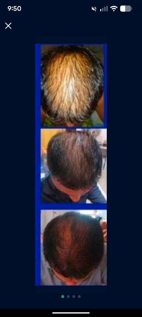 Shampoo Anti Caida Terramar