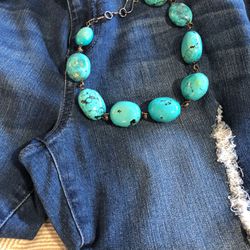 Turquoise-Must Have- Summer Accessory 🏖️