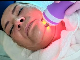 Radiofrecuencia Facial