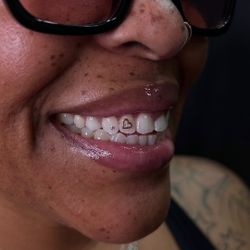 Tooth gems 