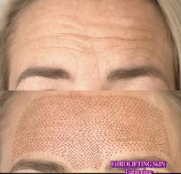 Skin Care