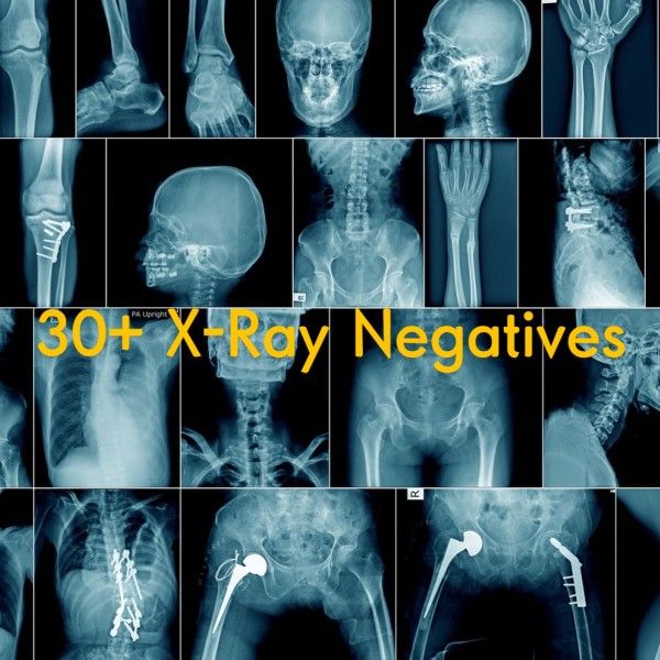 30+ (5 Lbs) X-Ray Negatives Goth Gothic Medical Educational Halloween Decor