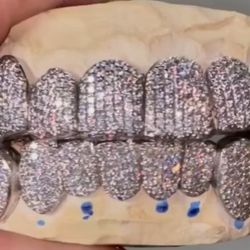 Gold Custom Grillz 