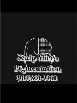 Scalp micro-pigmentation hair loss