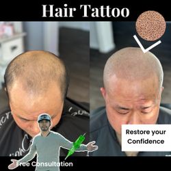 SMP Scalp Micropigmentation CA (SMPCA Academy)