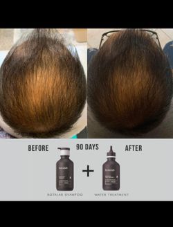 Hair Thining??