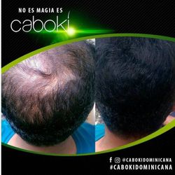 Fiber hair instant growth (esthetic)