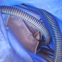 Hillrom pulomary vest