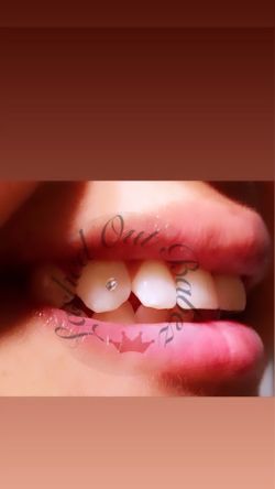 Tooth Gems
