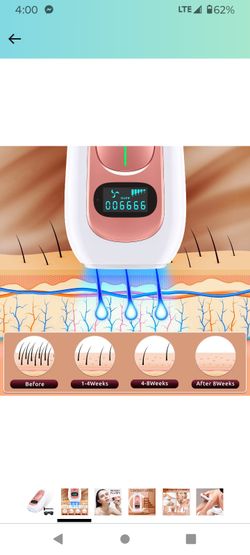 IPL Hair Removal for Women and Men, New Upgraded 999,900 Flashes Permanent  Laser Hair Removal Device on Facial Legs Arms Armpits Body, At-Home Use