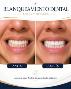 Whitening