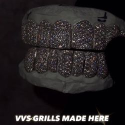 Custom Silver & Moissanite Grillz – 10 on 10