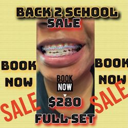 Full Braces Install Sale
