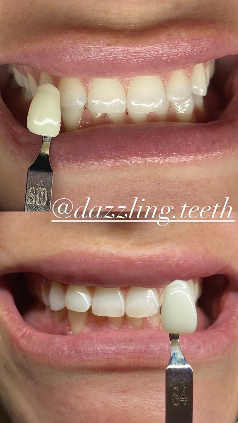 Teeth Lamp