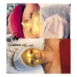 Facial 