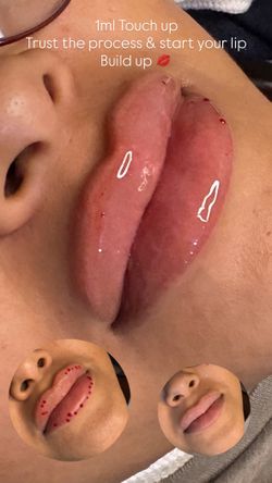 Lips