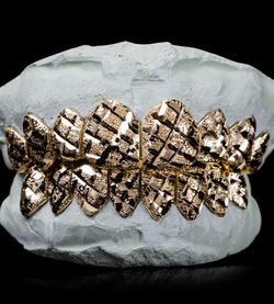 Custom Gold Grillz