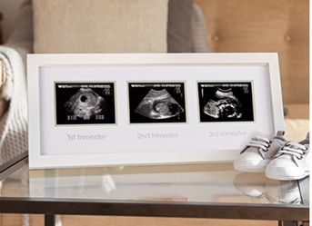 Triple sonogram pregnancy keepsake frame