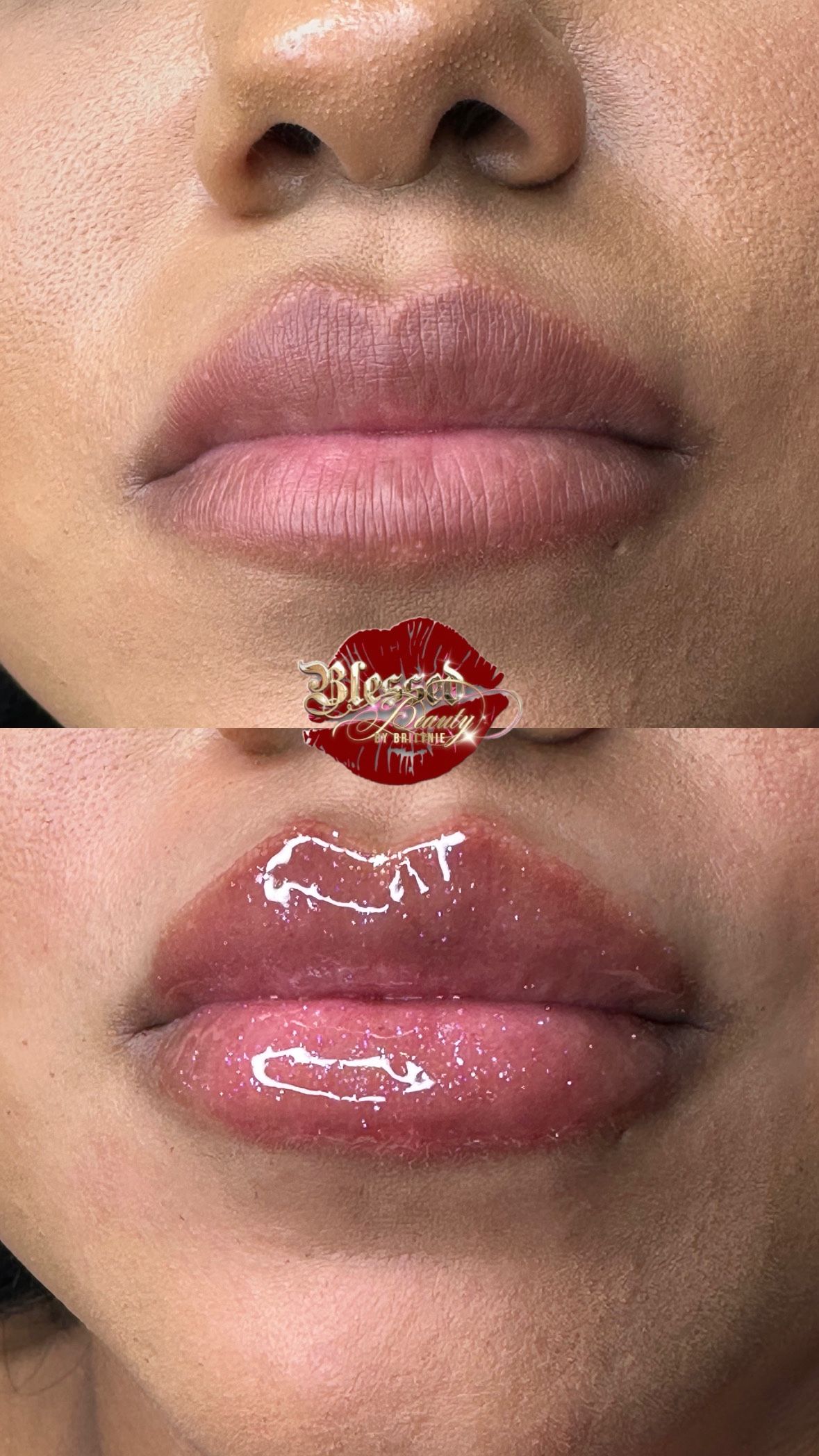 Lip Gloss
