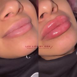 Lips /labios 💉👄