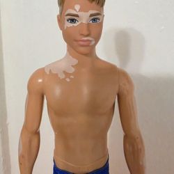 Mattel Barbie Fashionista #192 Malibu Ken Doll Vitiligo Skin Condition Awareness