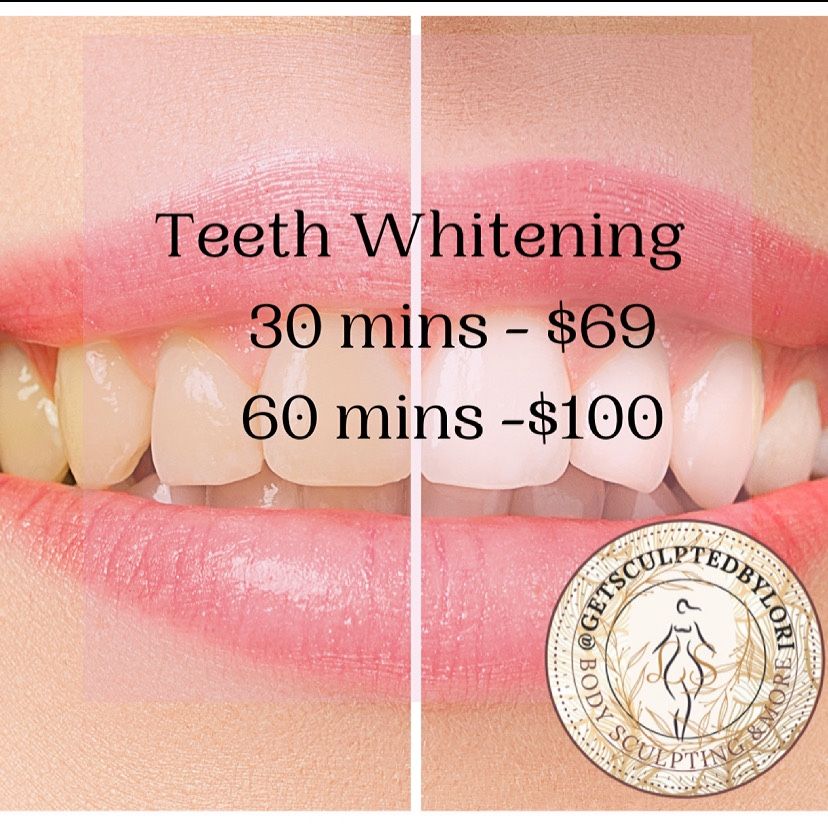 Cosmetic Teeth Whitening