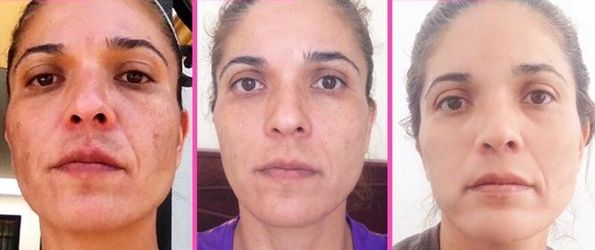 Crema regeneradora de la piel jackelina