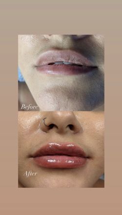 lips
