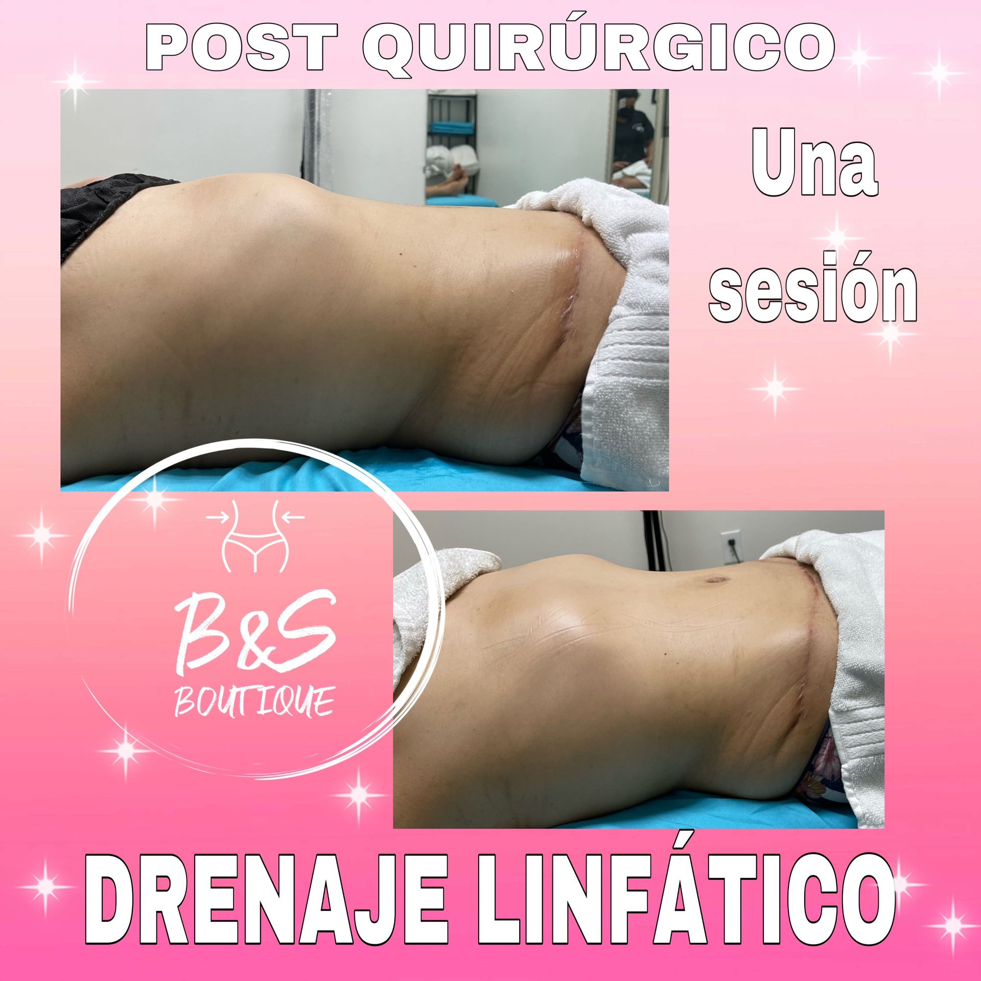 Cavitation 8 In 1 Machine For Sale Other - Health & Beauty