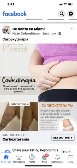Carboxiterapia