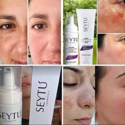 👋 Tienes Manchas En La Piel Aquí Está La Solución 